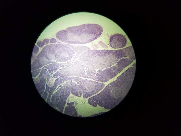 Thymus Slides - Thymus 002 40X